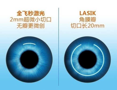 蔡司全飞秒3.0智能升级，优势何在?